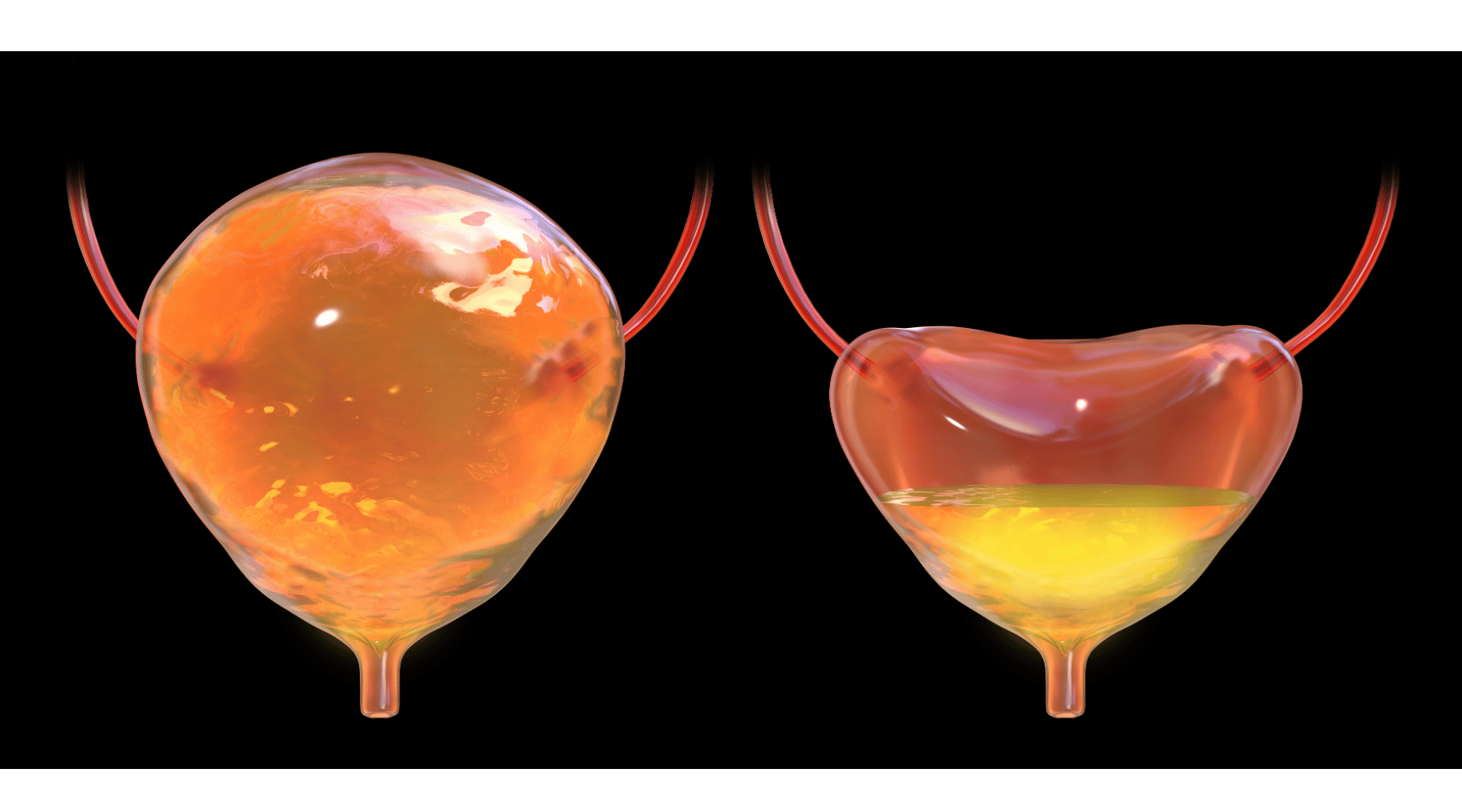 Understanding Your Bladder: A Vital Organ for Your Health